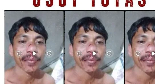 Madarudin Lapandewa Dianiaya, Pembina CLS-Yogyakarta, Haris: Ini Negara Demokrasi Berdasarkan Hukum