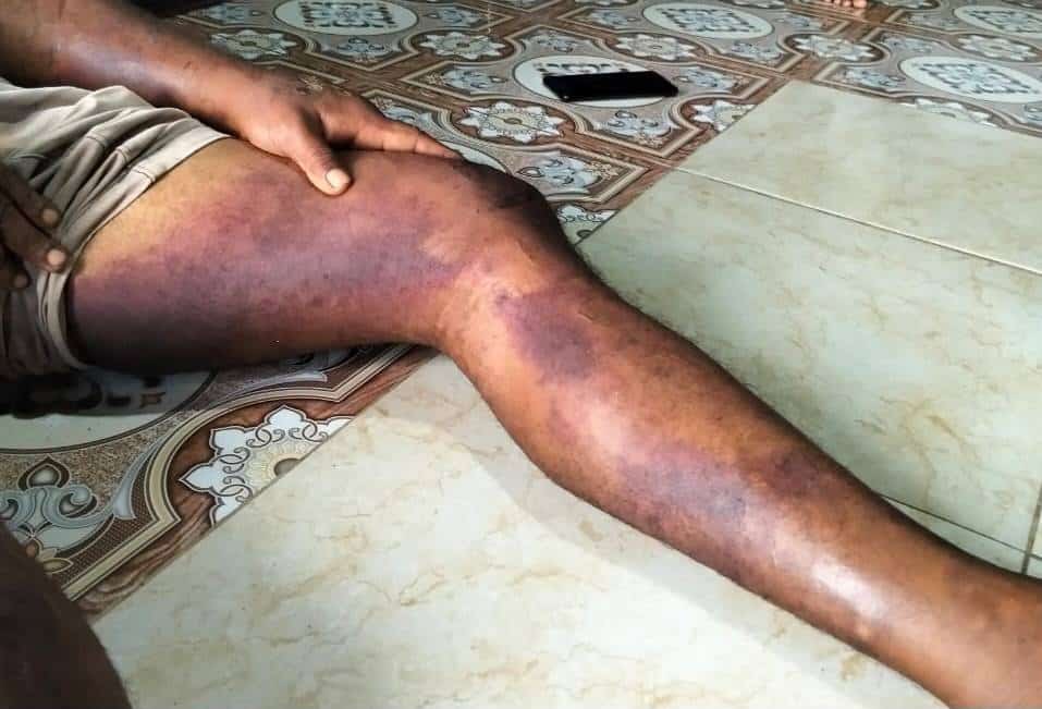 LBH Papua Pos Sorong Duga Kapolresta Lindungi Anggota dalam Kasus Penyiksaan Warga Sipil